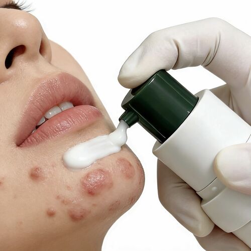 Latest company news about Airless Bottles for Acne Treatment